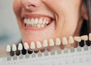 How Modern Dental Implants Are Transforming Smiles