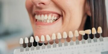 How Modern Dental Implants Are Transforming Smiles