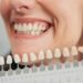 How Modern Dental Implants Are Transforming Smiles