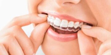 How Dental Implants Can Restore Your Smile and Confidence