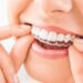 How Dental Implants Can Restore Your Smile and Confidence