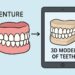 Denture Innovations: What’s New in Tooth Replacement
